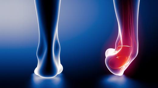 Ankle Sprain & Instability